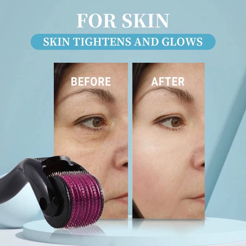 Derma Roller