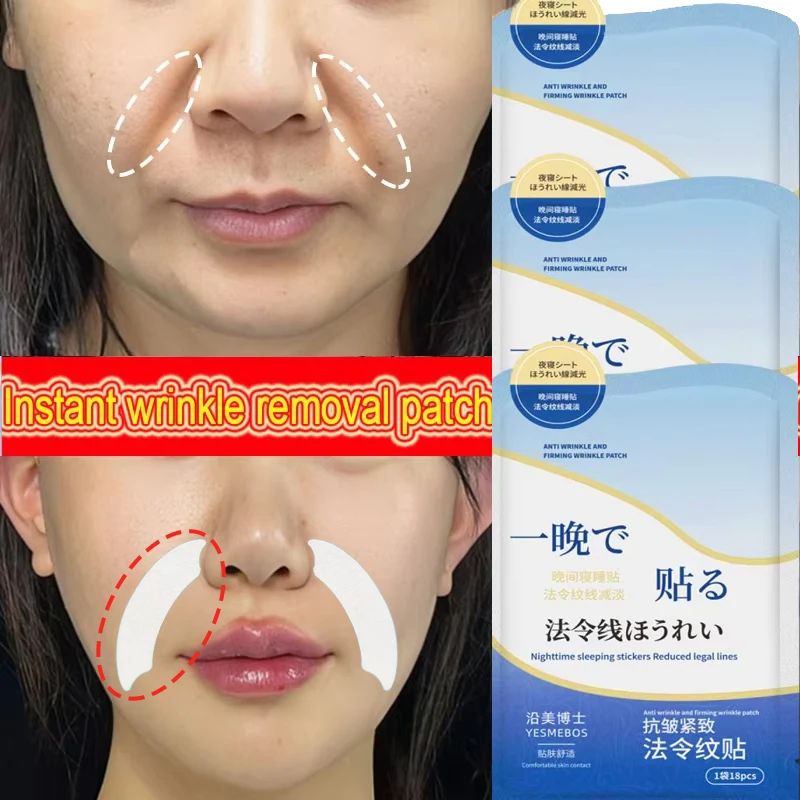 Collagen PDRN Nasolabial Folds