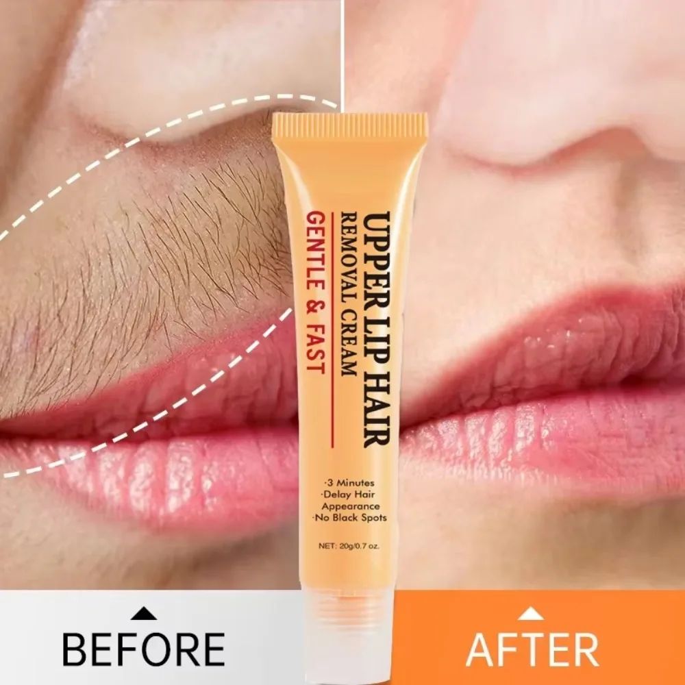 upper lip hair